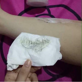 Kem triệt lông My miu