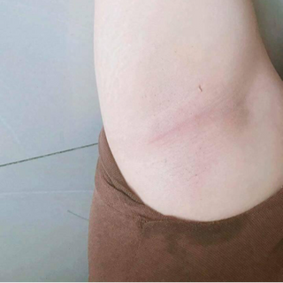 Kem triệt lông My miu