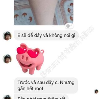 Serum trị thâm Mina