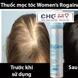 thuốc mọc tóc-râu-chân mày Rogaine minoxidil 5