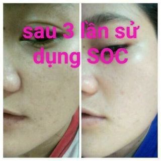 Sua Ong Chua Dep Da