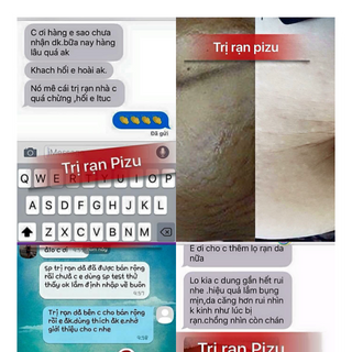 Dầu ngăn ngừa trị rạn da thiên nhiên Pizu