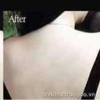 SỮA TẮM TRÀ XANH COLLAGEN