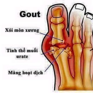 ĐẶC TRỊ XƯƠNG KHỚP NGỌC ANH