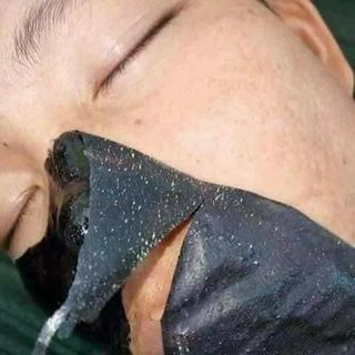 Gel Hút Mụn Than Tre Hoạt Tính Lê Thanh