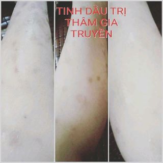 trị thâm gia truyền