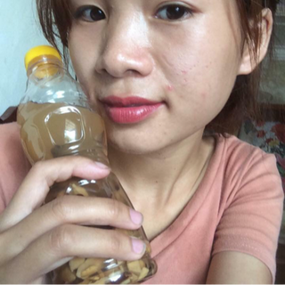 Trị Mụn Nám Tàn Nhang Đông y Gia truyền
