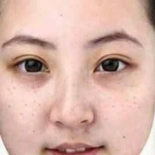MẶT NẠ NHAU THAI CỪU- PLACENTA AMPLE MASK
