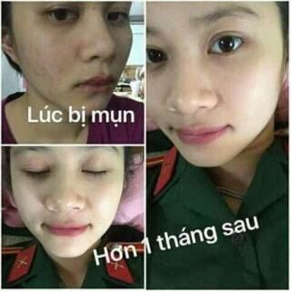 serum Kiều
