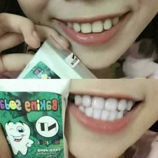 Bột trắng răng baking soda