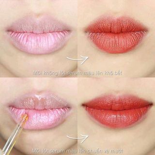 SERUM DƯỠNG MÔI