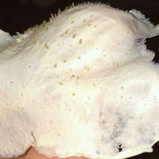 gel hut mụn