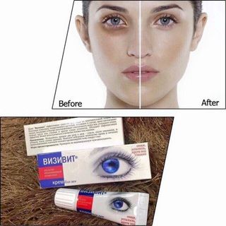 KEM ĐẶC TRỊ THÂM QUẦNG LÀM TAN BỌNG MẮT NGA