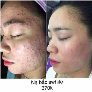 MẶT NẠ THẢO DƯỢC SWHITE