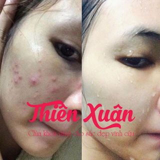 Thiên xuân - chìa khóa vàng cho sắc đẹp vĩnh cữu