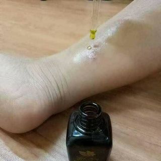 TINH DẦU TRỊ THÂM LINH HƯƠNG