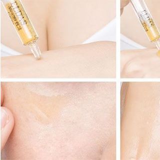 Serum TẾ BÀO GỐC ELDAS HÀN QUỐC