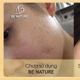 kem lụa sữa ong chúa