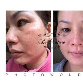 kem tái sinh đêm ta hạt mầm