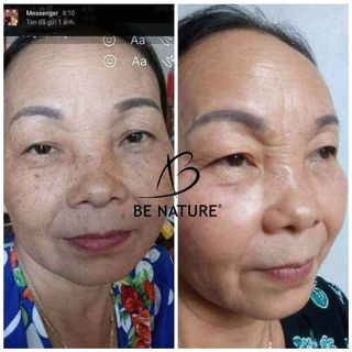 kem tái sinh đêm ta hạt mầm