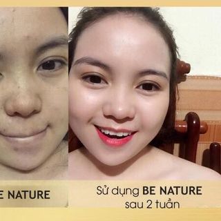 serum trị mụn