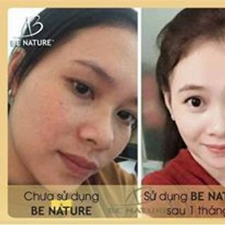 kem cốt đặc trị nám từ sáp ong
