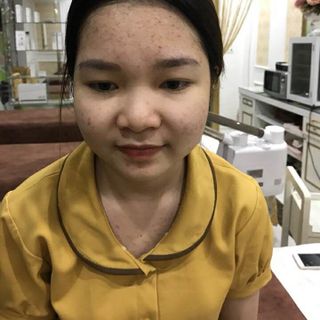 SERUM TRỊ NÁM / TÀN NHANG VỚI GSC