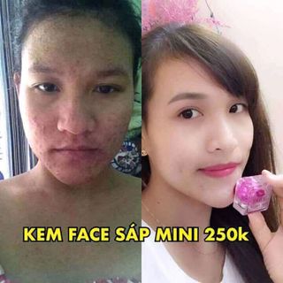 Kem ong sữa