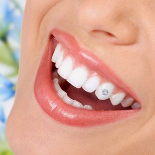 Đá Đính Răng size 2 - 2mm - Giá Sỉ 5k/viên