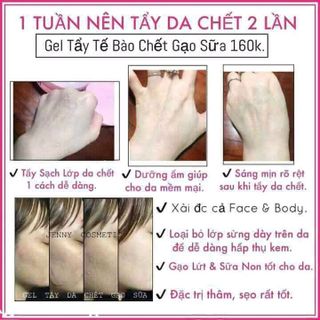 Gel tẩy tế bào chết