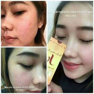 SERUM THẢO DƯỢC KIỀU BEAUTY QUEEN