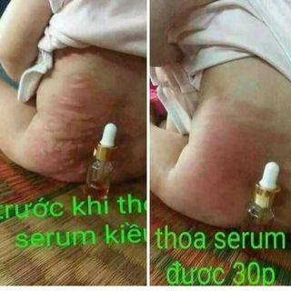 Serum Kiều Beauty Queen