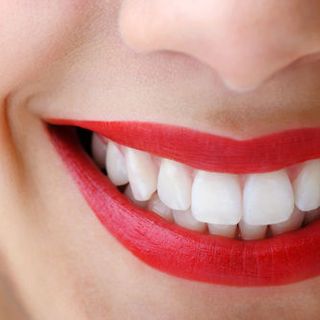 Miếng Dán Trắng Trắng Advanced Whitening Strips