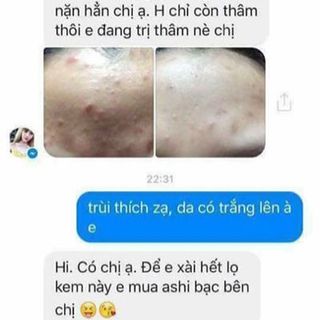 KEM TRỊ MỤN ASHI