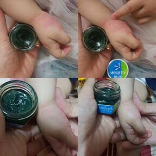 cao trị muỗi đốt Thái Lan