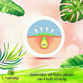 Serum Mụn
