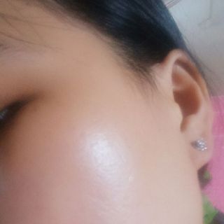 Serum dưỡng