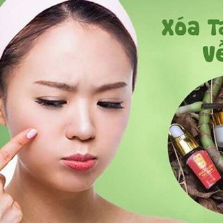 trị mụn đông y CUNG ĐÌNH HUẾ