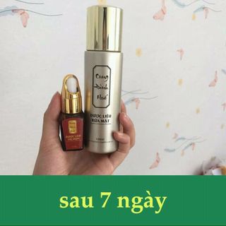 trị mụn đông y CUNG ĐÌNH HUẾ