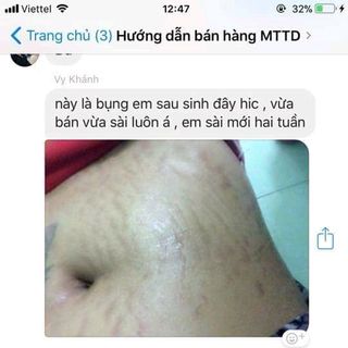mỡ trăn thảo dược