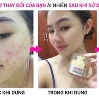 Gluta White - MIRACLE CLEAN ANCES - kem sạch mụn không còn vết thâm