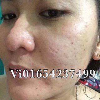 Bộ Tái Tạo Ngọc Linh Sâm