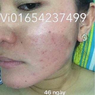 Bộ Tái Tạo Ngọc Linh Sâm