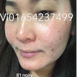 Bộ Tái Tạo Ngọc Linh Sâm