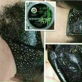 Gel lột mụn than tre Lê Thanh