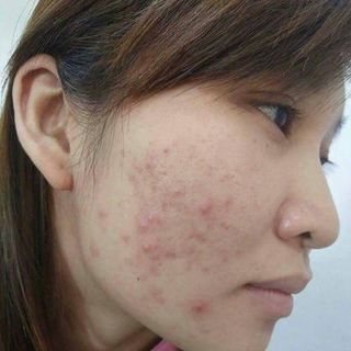 Tinh chất tái tạo da Tiên Tiên Dược