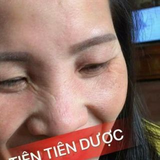 Tinh chất tái tạo da Tiên Tiên Dược