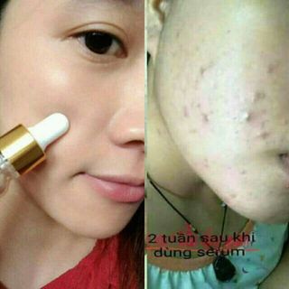 Serum Kiều