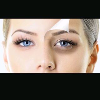 kem trị thâm quầng mắt