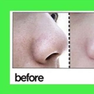 Tẩy da chết Appletox Smooth Massage Peeling Gel